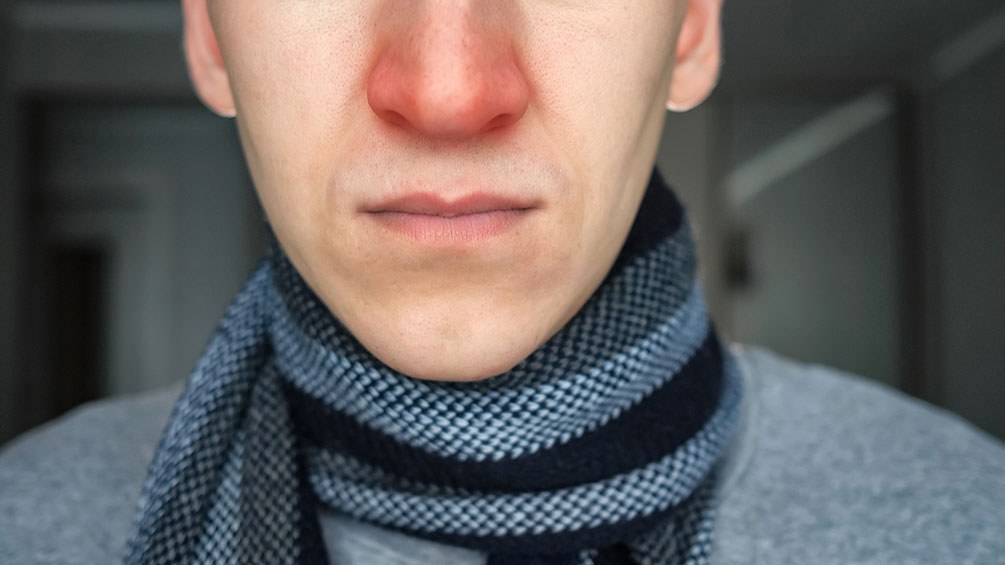 Rote nase erkaeltung